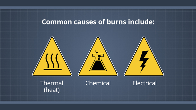 chemical burn first aid